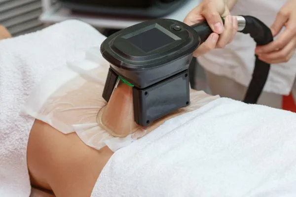 Image of person having fat freezing treatment to help weight gain Crawley