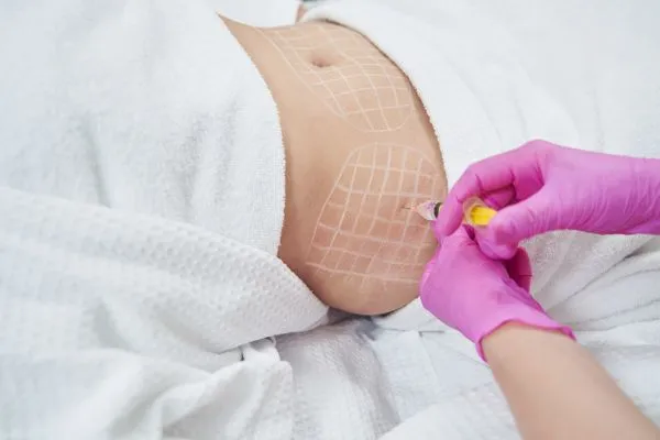 image of fat dissolving injections on love handles to help combat weight gain Crawley