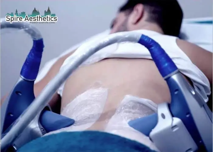 Man having fat freezing treatment done on love handles before a competitions Crawley to create a sculpted look.