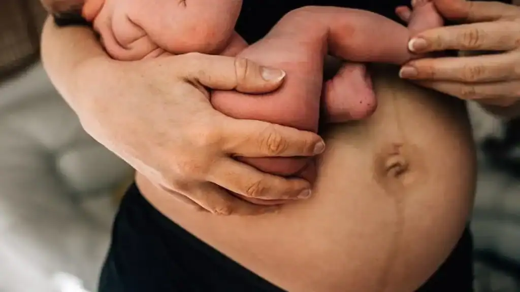 Why Is My Stomach Still Big After Pregnancy Crawley?